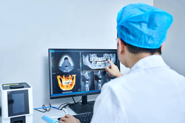 Best Emergency Gum Treatment in Santee, CA